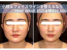 ミエル 神戸店(Miel)の雰囲気（小顔＆皮膚たるみ改善◎ハイウェーブ初回体験19,800円）
