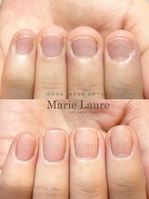 マリーロール 梅田店(Marie Laure)/深爪矯正/自爪育成/自爪風