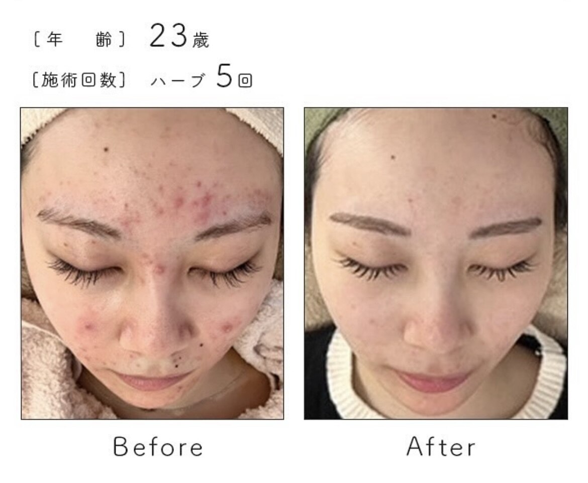 シックスティーエイトフェスター(68FESTAR☆)｜ホットペッパービューティー