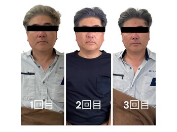 ブライトプラス(BRIGHT+)/小顔整体+ハイドロ小顔ケア