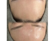 アエ メゾン(ae maison)の雰囲気(クリスタルスキンピーリングでつやつや水光肌に☆)