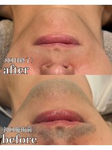 ミーエイト(Mii∞)/《ヒゲBefore/After》