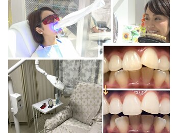 ネイルサロン ヴィヴィ(nail salon ViVi)の写真/憧れの白い歯をセルフホワイトニングで実現！初めてでも簡単＆スピーディー。リラク空間でリフレッシュ◎