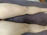 【５月限定】スライドカッピング+オイルリンパ６０分５０００円