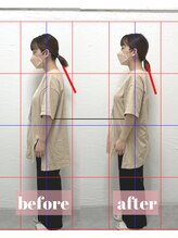 整体アンドボディメイク 禅/【ねこ背矯正】施術回数１回