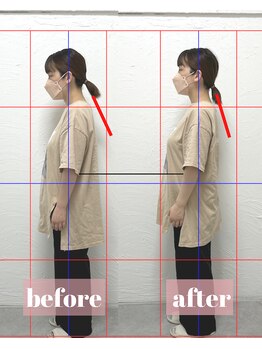 整体アンドボディメイク 禅/【ねこ背矯正】施術回数１回