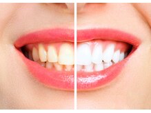 エクシアホワイトニング 新小岩店/2～4トーン白くなります！