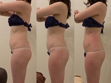 ラヴィエ ベル(La vie est belle)/セルライトゼロ2 全身