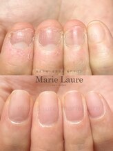 マリーロール 淀屋橋本店(Marie Laure)/自爪育成/深爪矯正/ネイルケア