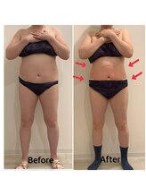 スペチアーレ 夙川/要らない脂肪はトイレ流す