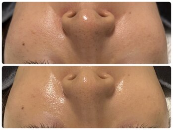 エフェクト 塚口店(effect)/before after