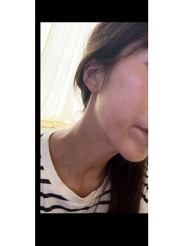 おぐの和/焼肉・ビールからの次の日