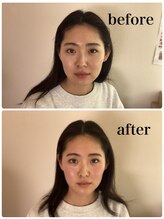 スパ 香炉/GUINOT美容機器VARフェイシャル