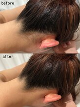 スパ ナナプラス(SPA nana+)/全身脱毛