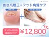 【巻き爪矯正+角質セット】UPジェルで補正★巻き爪ケア2本+角質ケア￥12,800
