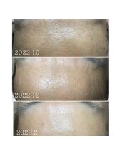 プアラ(puala)/鼻だけじゃない！この変化！