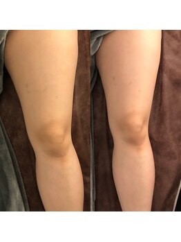 ディライト 名古屋駅店(Delight)/バンビ脚！！