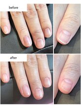 ケアプラス(care plus)/ハンドネイルケア