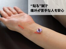 美楽っくすの雰囲気(【鍼灸】鍼が怖い方でも刺さない施術で安心安全に受けられます♪)