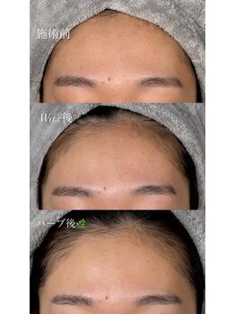 フーフラット(Huu flat)/ワックス×ハーブ