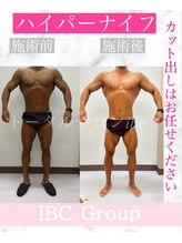 トータルサロンアイビーシー(トータルサロンIBC)/ハイパーナイフ：カット出し