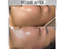 エステ リラクゼーションサロン(more)の雰囲気（その場しのぎケアではなく持続的な”肌育”で一生モノの素肌作り）