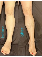 プライベートサロン ルクサージュ(Luxeage)/