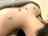 【2回目以降のご来院の方へ】全身鍼灸