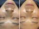 エビスラボ(Ebisu Labo)の写真/【1度で変化・違いが分かる】年齢を気にしない肌作りを♪艶肌・毛穴レス・ノンファンデーション肌