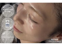 ルミグロウ(Lumi.Glow)の雰囲気（本当に良いと感じたものだけを厳選した本格肌質管理を大分で―.）