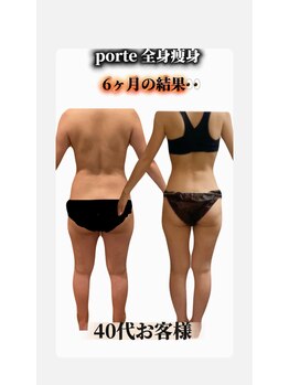 ポルテ バイ ハルモ(porte by Harmo)の写真/【多賀城市初導入！最新痩身マシン】40代からの本気痩せ！短期集中で理想のメリハリボディへ♪