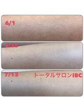 トータルサロンアイビーシー(トータルサロンIBC)/全身美肌脱毛(VIO込み)20分♪