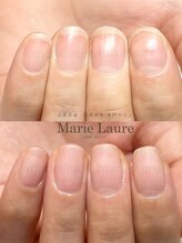 マリーロール 淀屋橋本店(Marie Laure)/自爪育成/深爪矯正/ネイルケア