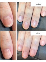 ケアプラス(care plus)/ハンドネイルケア