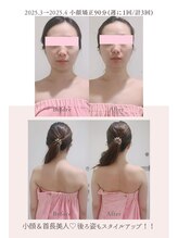 トゥインクル 麻布(twinkle)/南麻布/シンメトリー小顔矯正