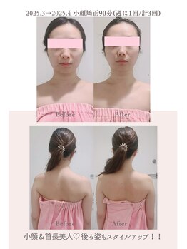 トゥインクル 麻布(twinkle)/南麻布/シンメトリー小顔矯正