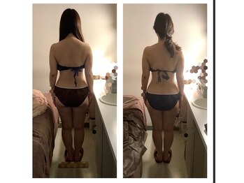 アクア エステティコ 亀有(ACQUA estetico)/脂肪燃焼6回