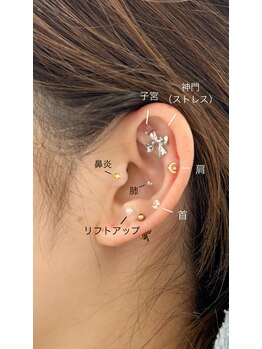 アール 天神南(R)/耳ツボジュエリー