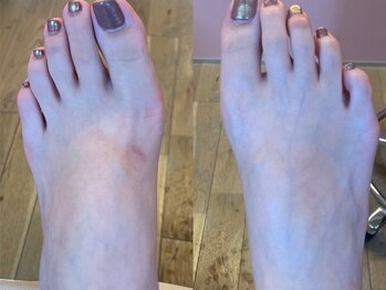 エミュネイル 関内(emunail)/フットケア