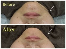 ウード(oud.)/小顔にしたい☆