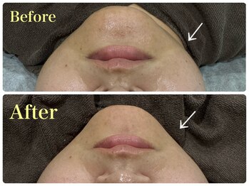 ウード(oud.)/小顔にしたい☆