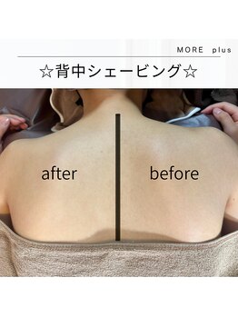 モアプラス(MORE plus)/背中シェービング