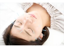 たかこの鍼の雰囲気(眼精疲労やお肌のお悩みに美容鍼が効果的♪)