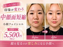 ソワラ 札幌