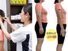 大山整骨治療院の雰囲気（定番人気の耳ツボ体験＋ダイエットカウンセリング☆1980円☆痩身）