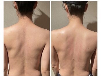 小顔フェイスラボ 浜松店(小顔FaceLabo.)/【実際の変化】小顔&整体コルギ