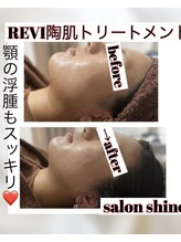 サロンシャイン(Salon Shine)/REVIハーブ１回２０代女性