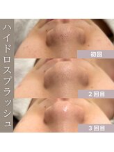 シアー(SHEER)/■ハイドロスプラッシュ