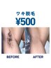 【超快適♪】ニオイエチケット★両ワキ500円脱毛  / メンズ脱毛