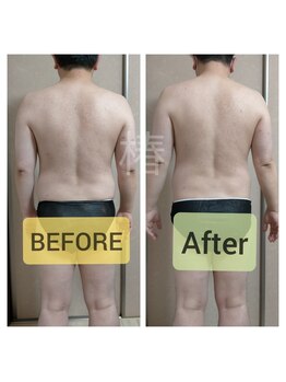 痩身 脱毛専門サロン 椿/メンズ痩身